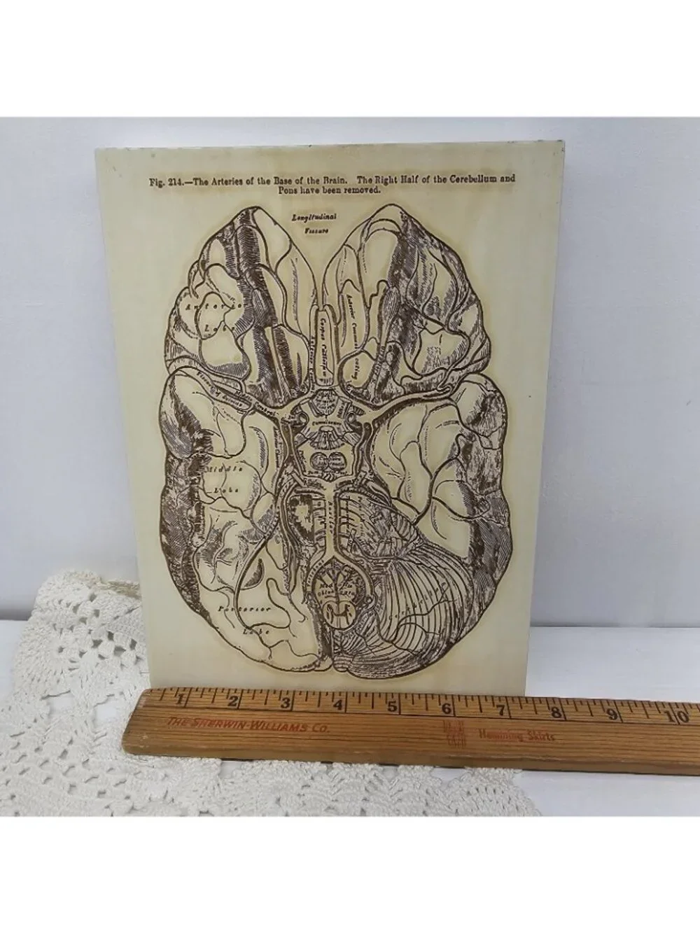 Vintage Gray’s Anatomy Brain Arteries Wood Wall Plaque Medical Art Doctor Gift